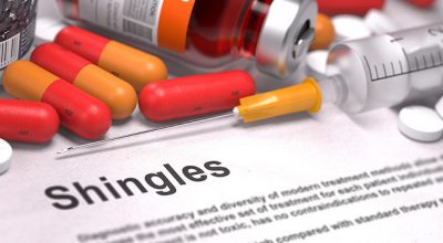 Shingles Treatment Dallas