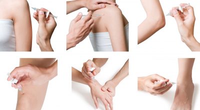 joint-Injection