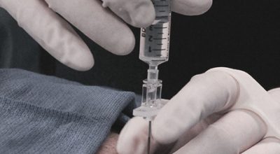 Epidural Steroid dallas