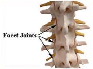 Facet Joint Injections dallas