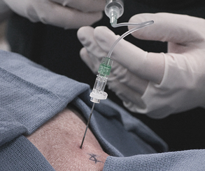 Epidural Steroid injection dallas