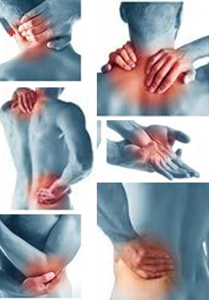 Myofascial-Pain-Syndrome-dallas