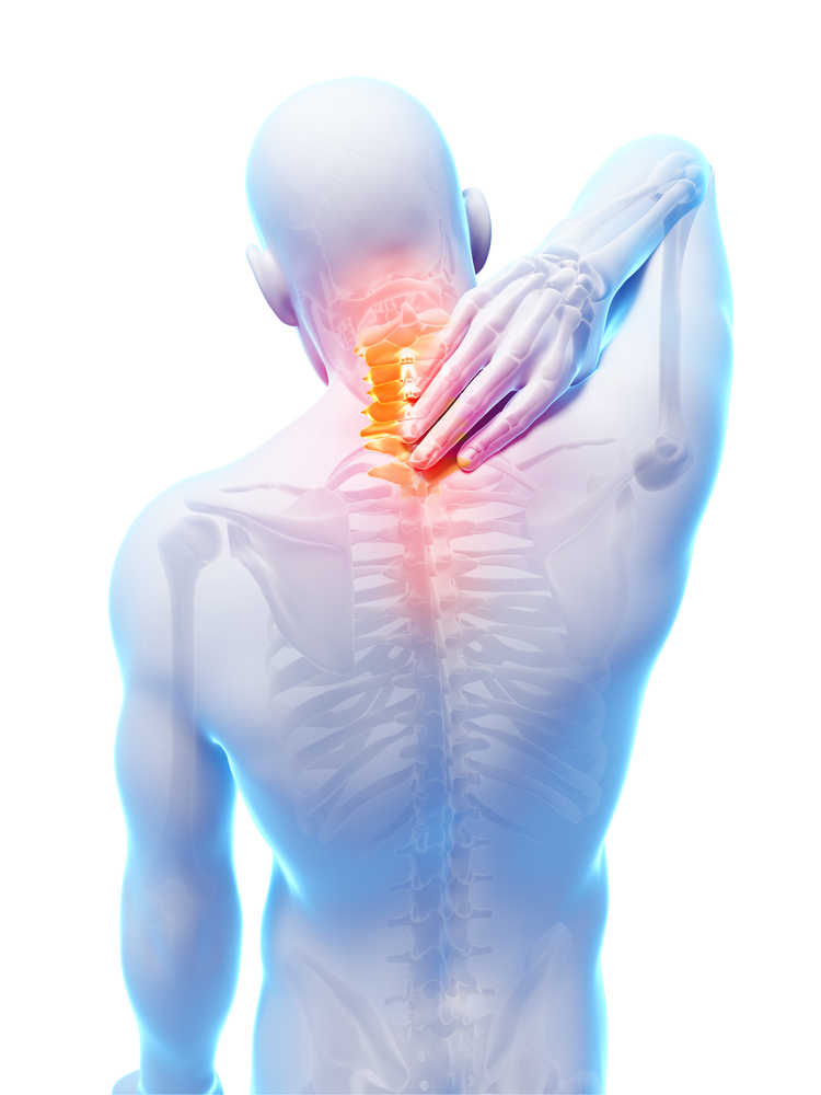 Myofascial-Pain-Syndrome dallas