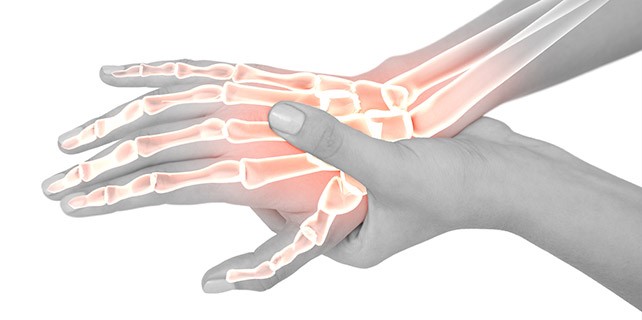 carpal tunnel pain dallas