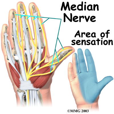 carpal tunnel syndrome dallas