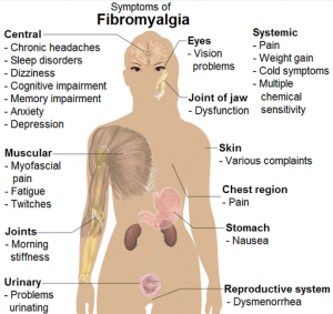 fibromyalgia symptoms dallas