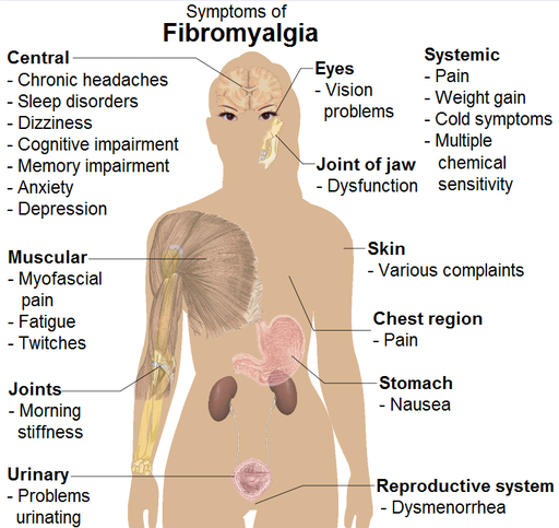 fibromyalgia-symptoms-dallas fibromyalgia symptoms dallas