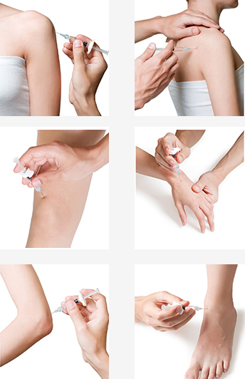 joint Injection dallas - Joint Injections (hip/knee/shoulder,wrist)