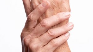 arthritis hand pain dallas