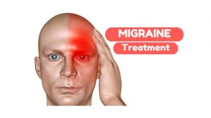 migraine treament dallas