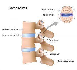 facet-joints-dallas