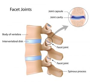 facet-joints-dallas