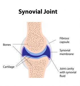 synovial-joint pain dallas