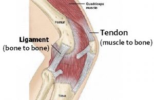 tendon-ligament pain