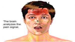 brain-analyze-the-pain-signal